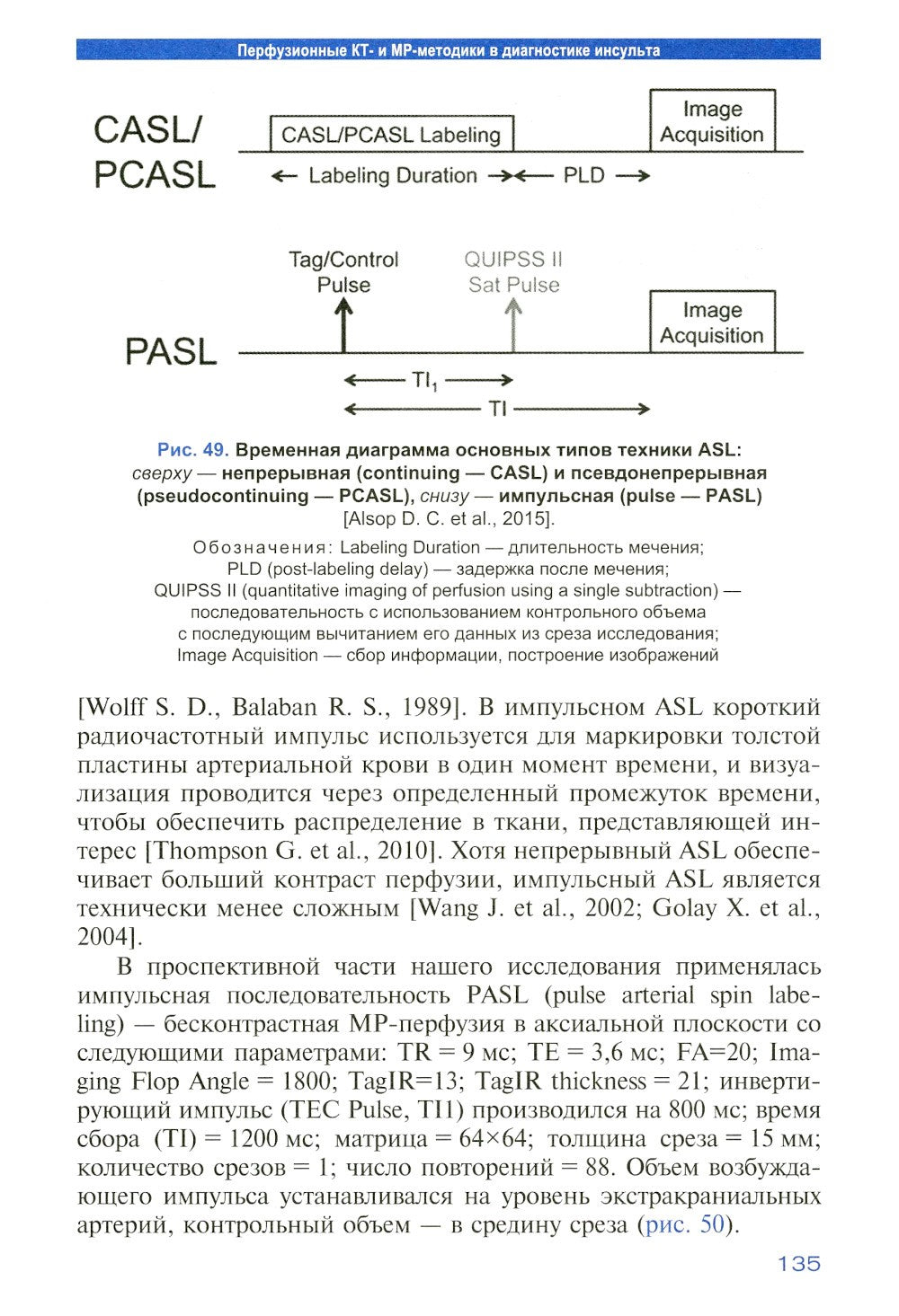 Лучевая диагностика венозного ишемического инсульта