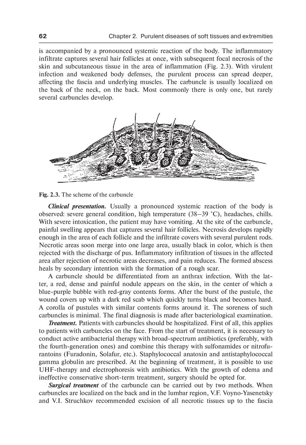 Surgical diseases: textbook. In 2 v. V. 1: на англ.яз