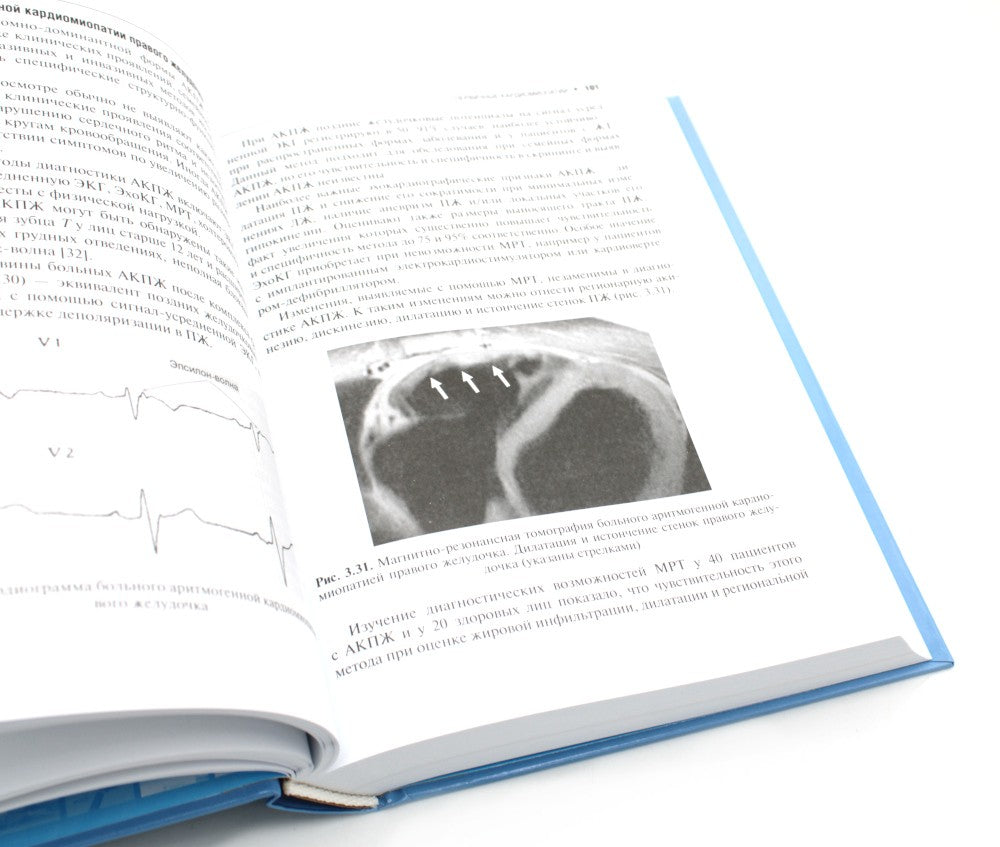 Кардиомиопатии и миокардиты. 2-е изд., перераб. и доп