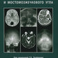 Лучевая диагностика заболеваний оснований черепа и мостмозжечкового угла: Уче...