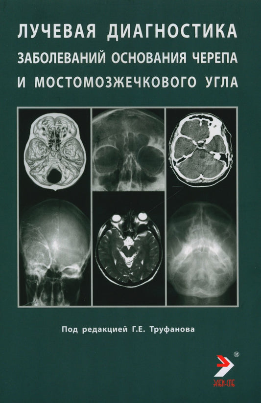 Лучевая диагностика заболеваний оснований черепа и мостмозжечкового угла: Уче...