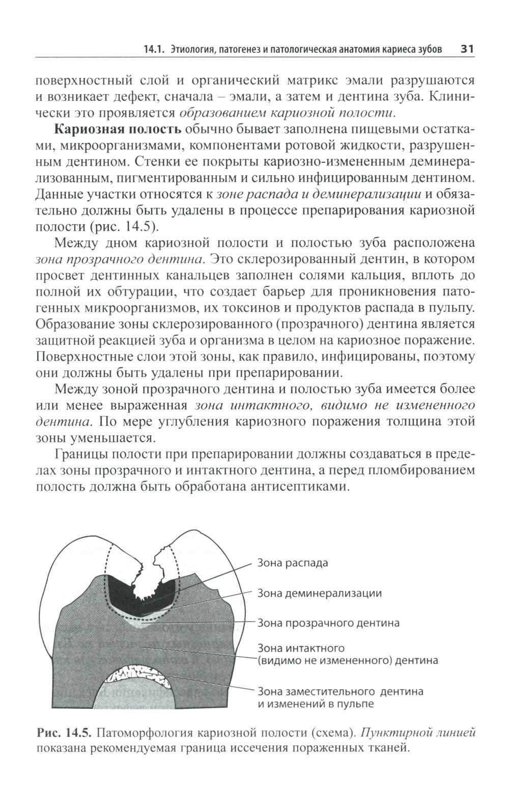 Практическая терапевтическая стоматология: Учебное пособие. В 3 т. Т. 2. 11-е...