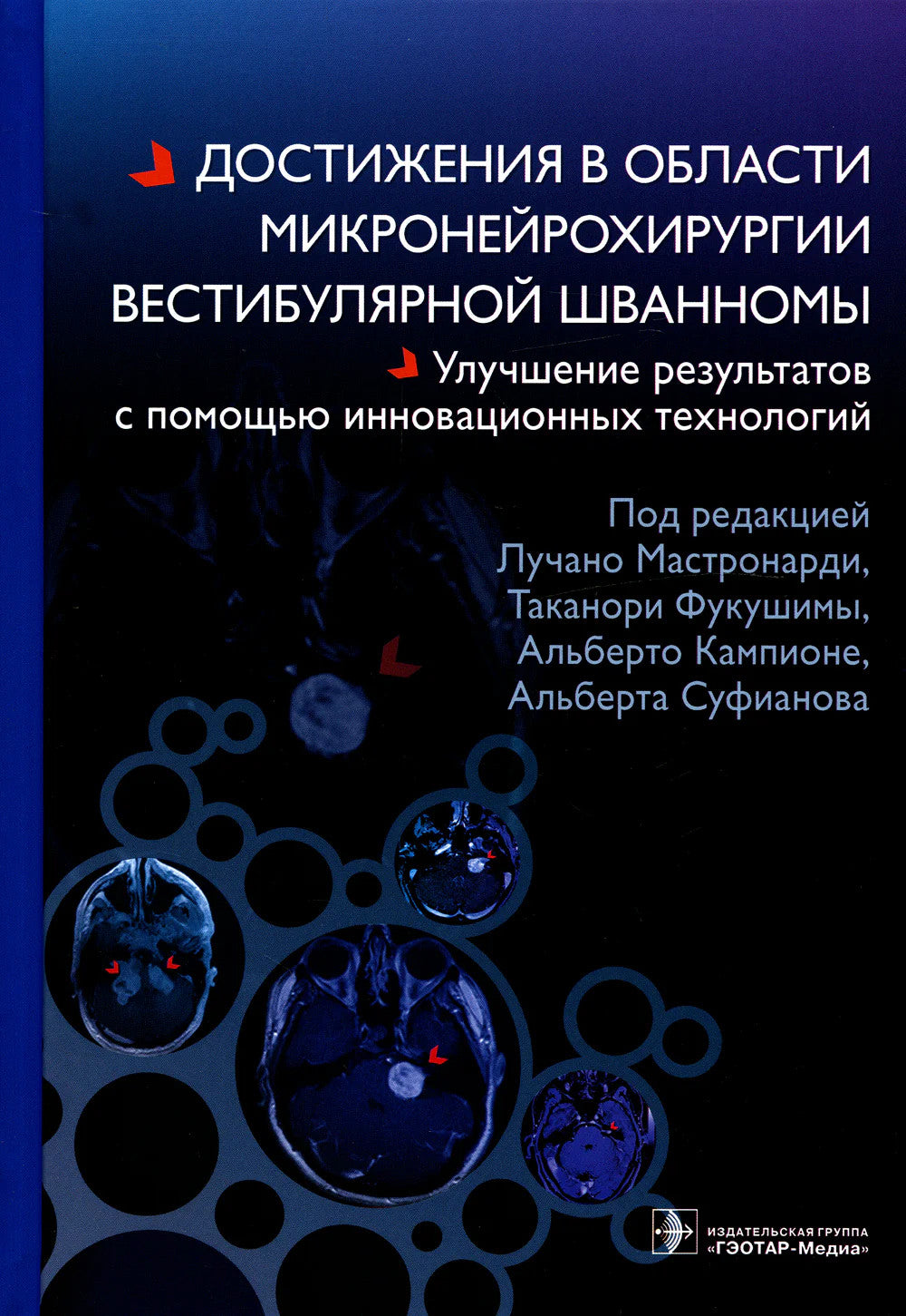 Достижения в области микронейрохирургии