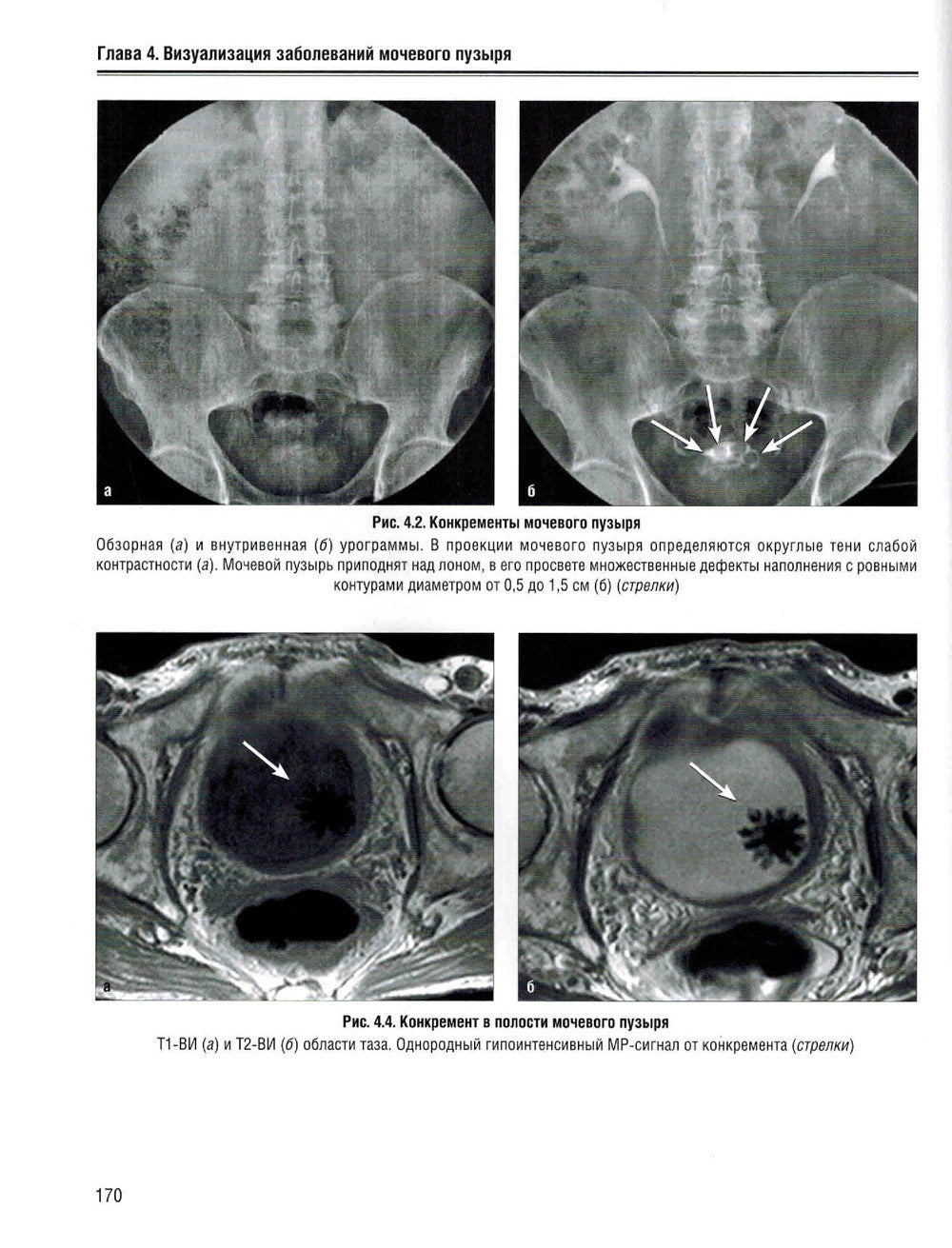 Визуализация заболеваний почек, мочеточников и мочевого пузыря: Учебное пособие