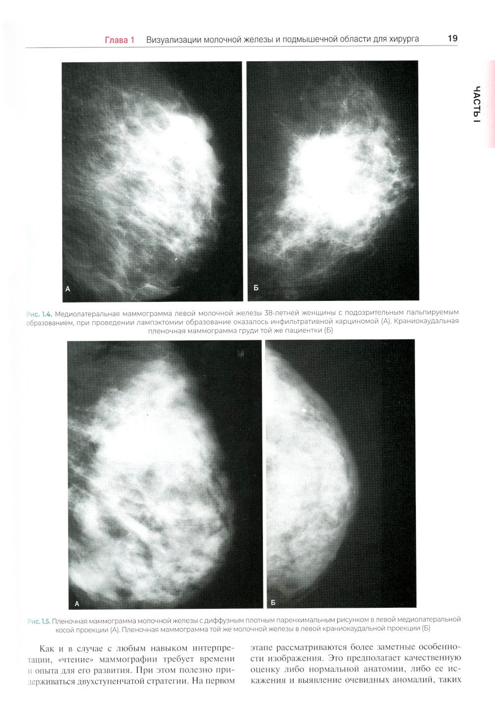 Хирургия молочной железы