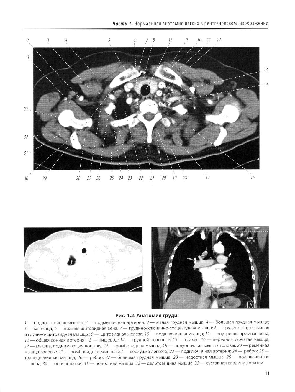 Визуализация заболеваний легких и средостения