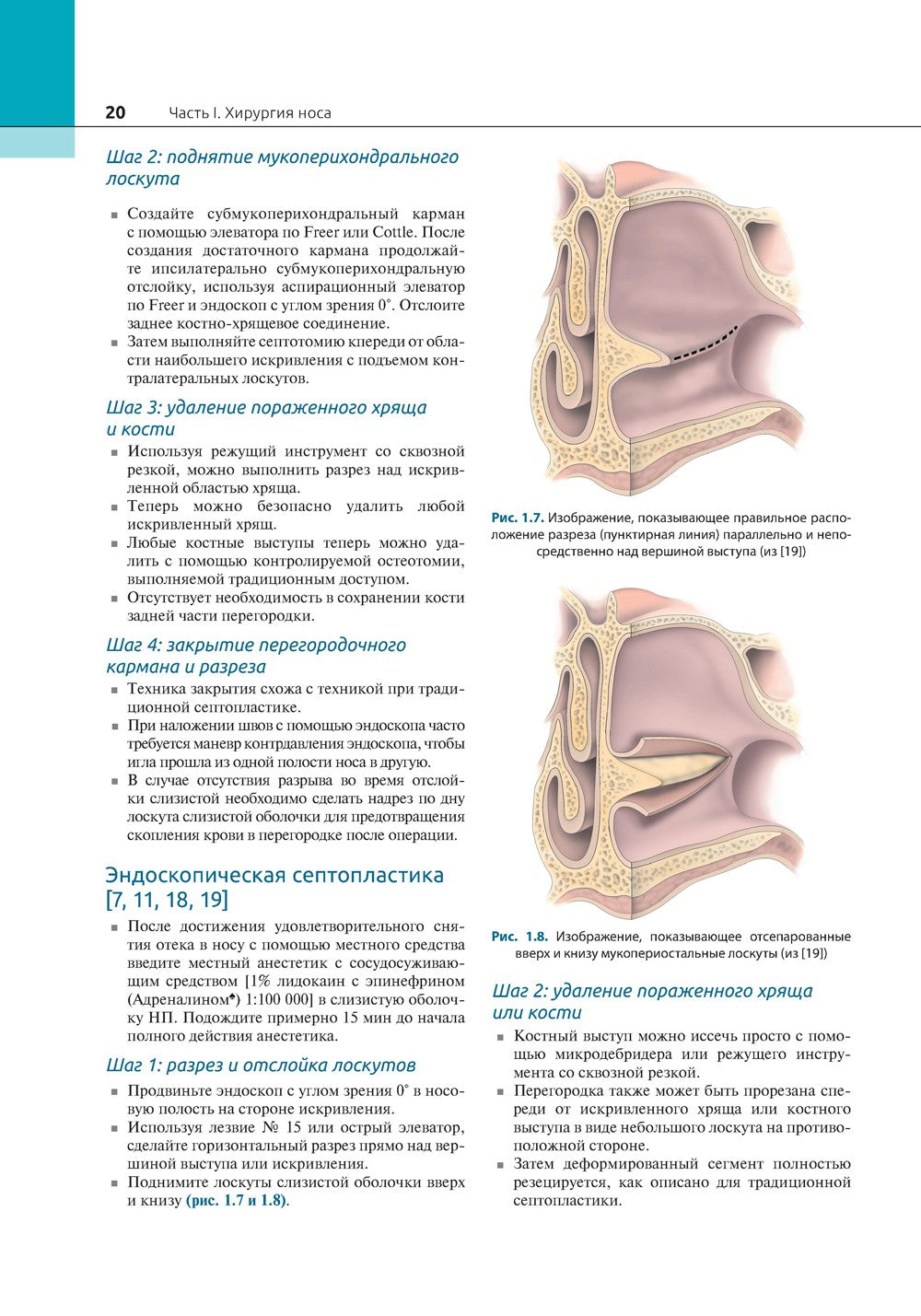 Атлас эндоскопической хирургии околоносовых пазух и основания черепа