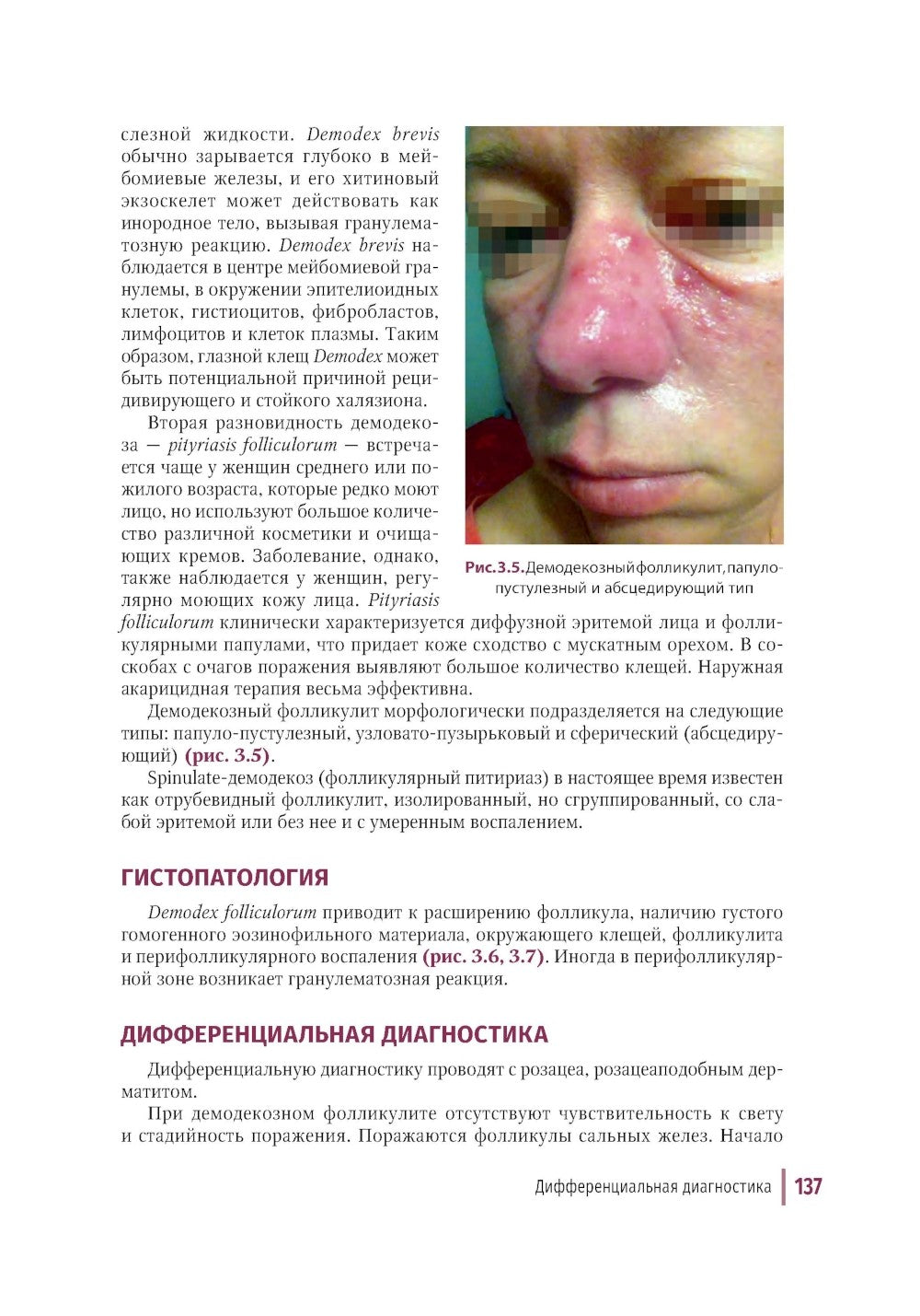 Дерматозы лица: иллюстрированное руководство для врачей