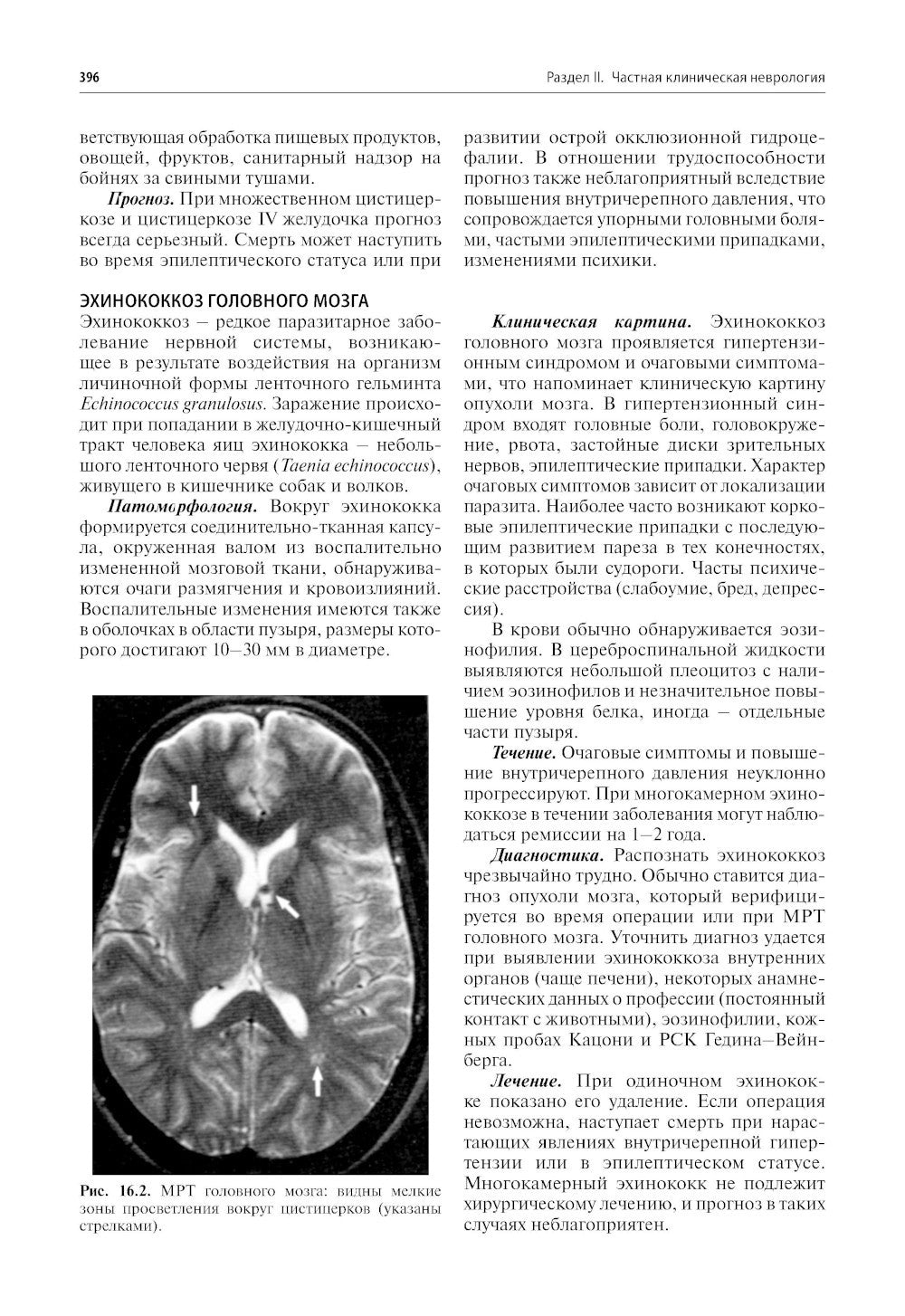 Нервные болезни: Учебник. 13-е изд