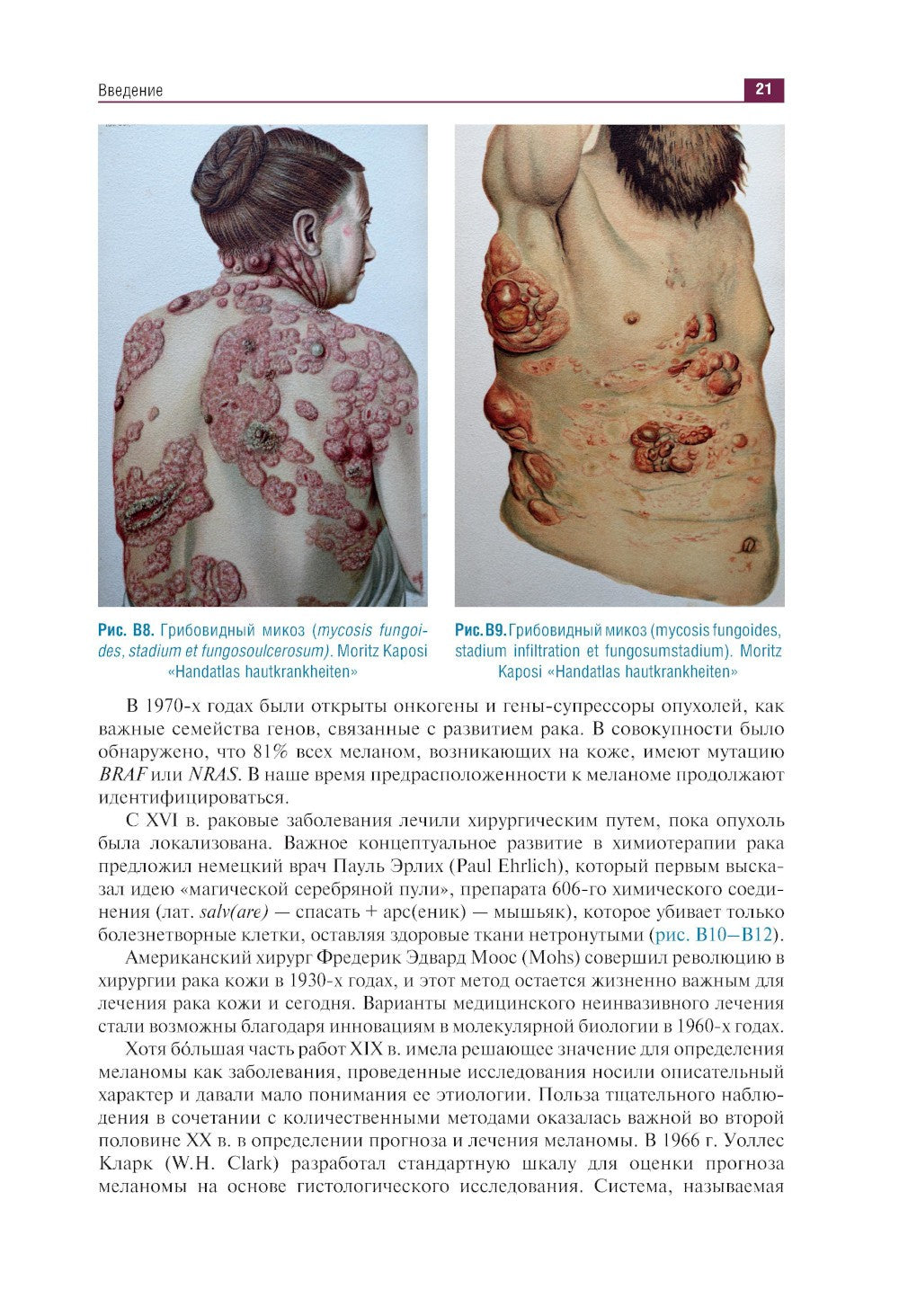 Дерматоонкопатология: иллюстрированное руководство для врачей