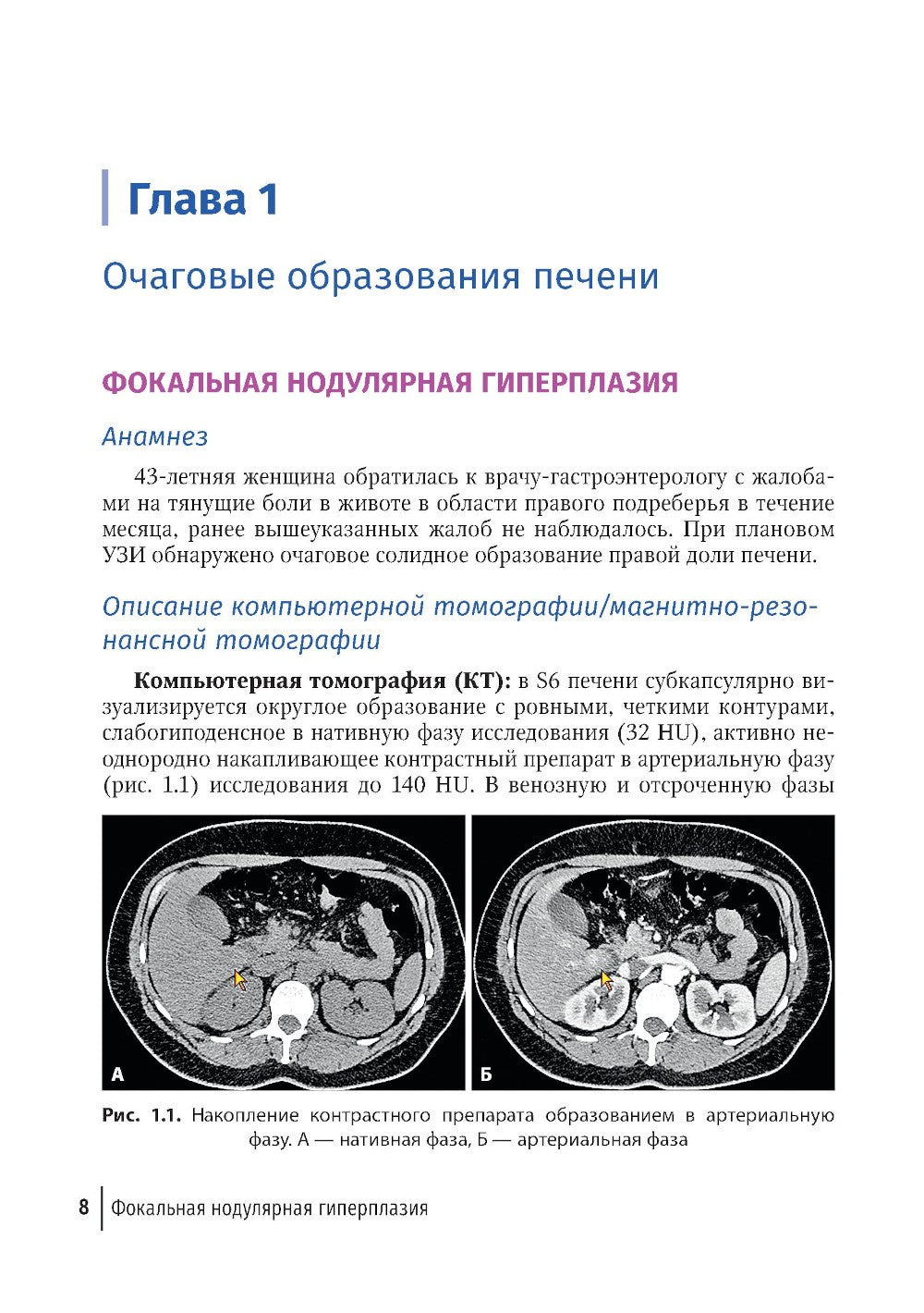 Трудности интерпретации данных КТ и МРТ: печень