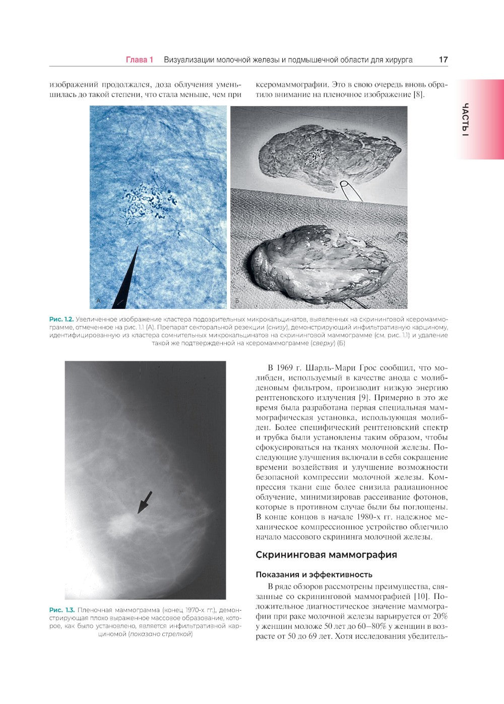 Хирургия молочной железы