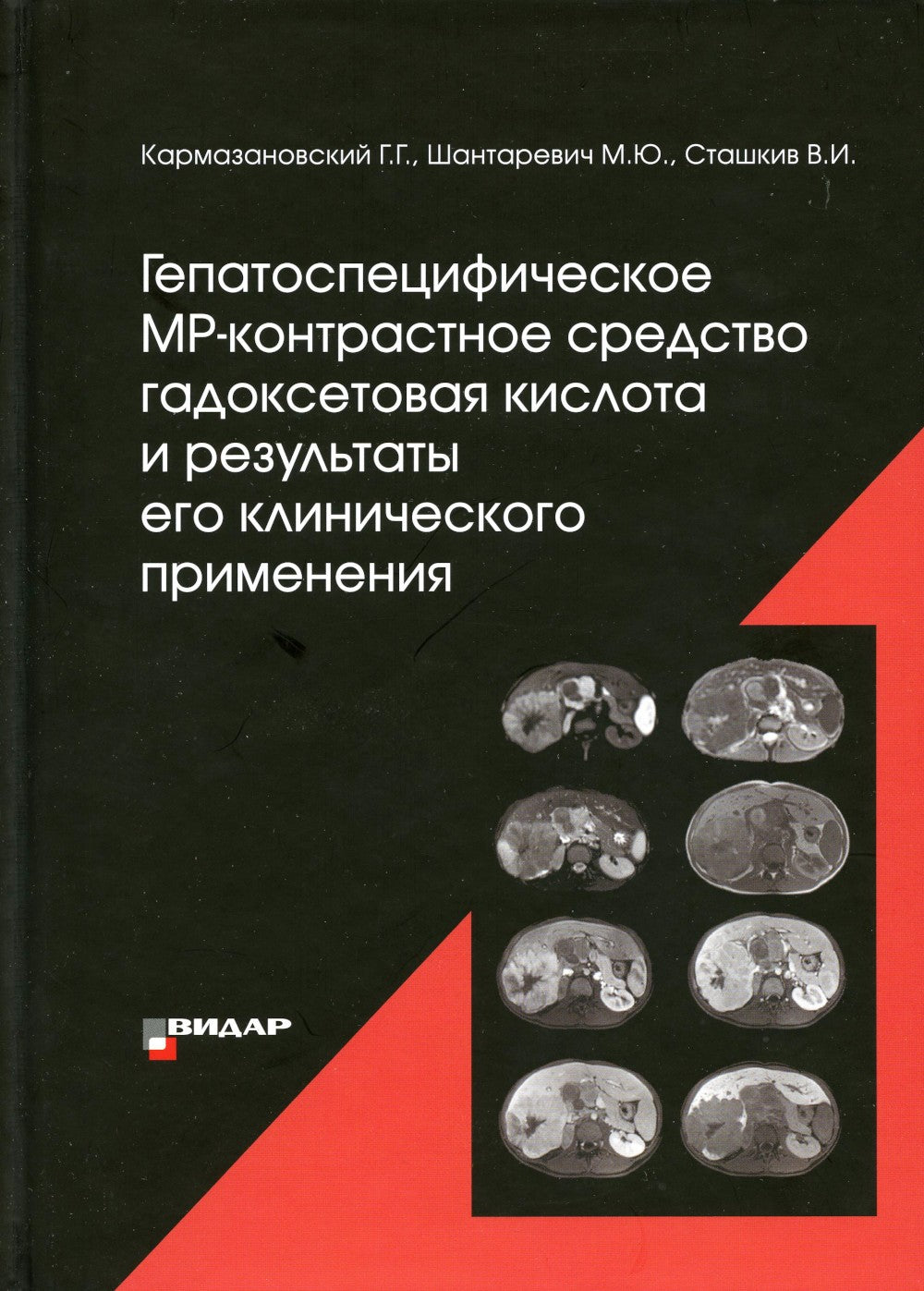 Гепатоспецифическое МР-контрастное средство «гадоксетовая кислота» и результа...