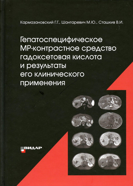 Гепатоспецифическое МР-контрастное средство «гадоксетовая кислота» и результа...