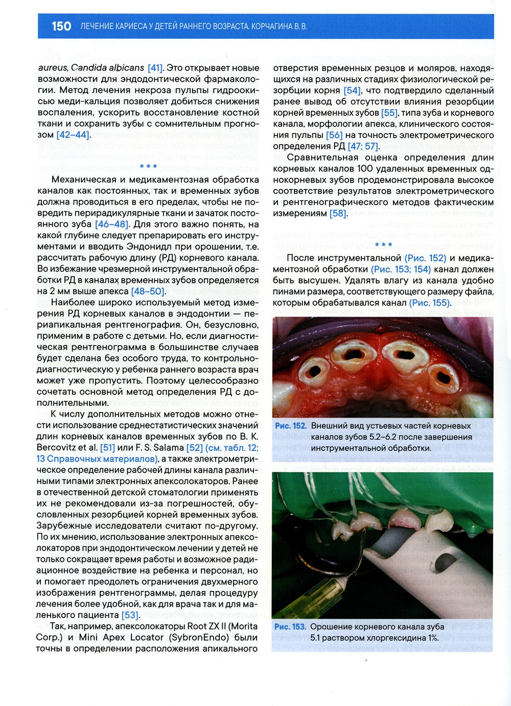 Лечение кариеса у детей раннего возраста