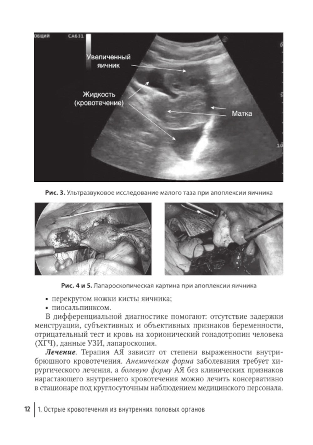 Острый живот в гинекологии: руководство для врачей