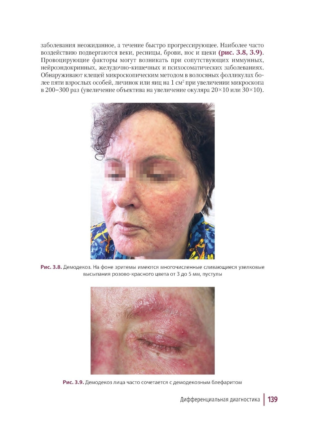 Дерматозы лица: иллюстрированное руководство для врачей