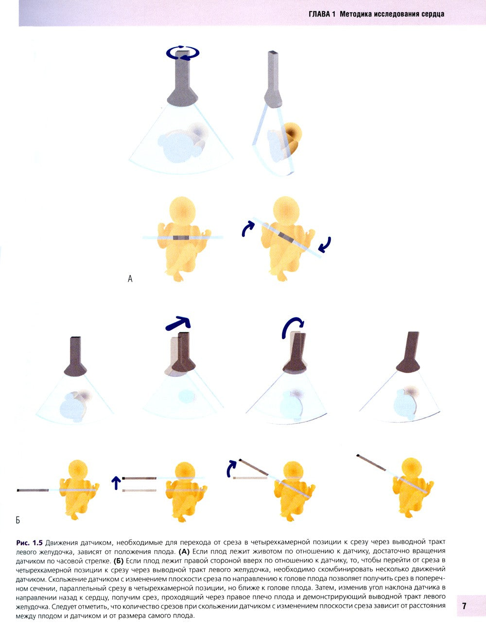 Эхокардиография плода: практическое руководство. + DVD