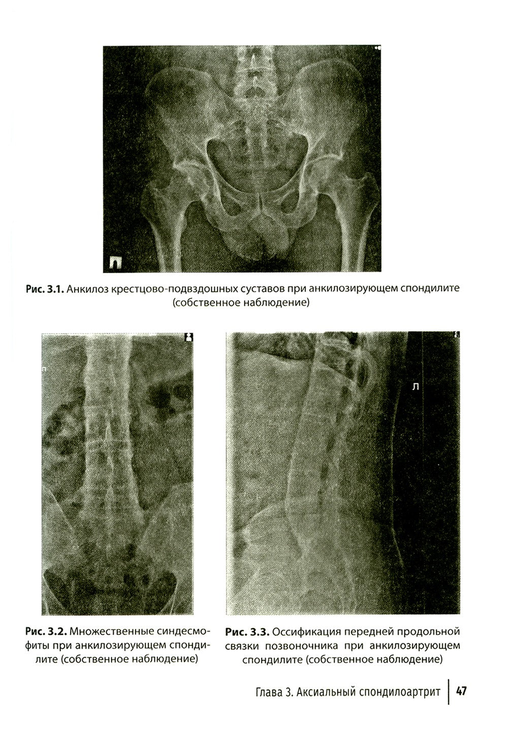 Боль в спине как междисциплинарная проблема: руководство для врачей
