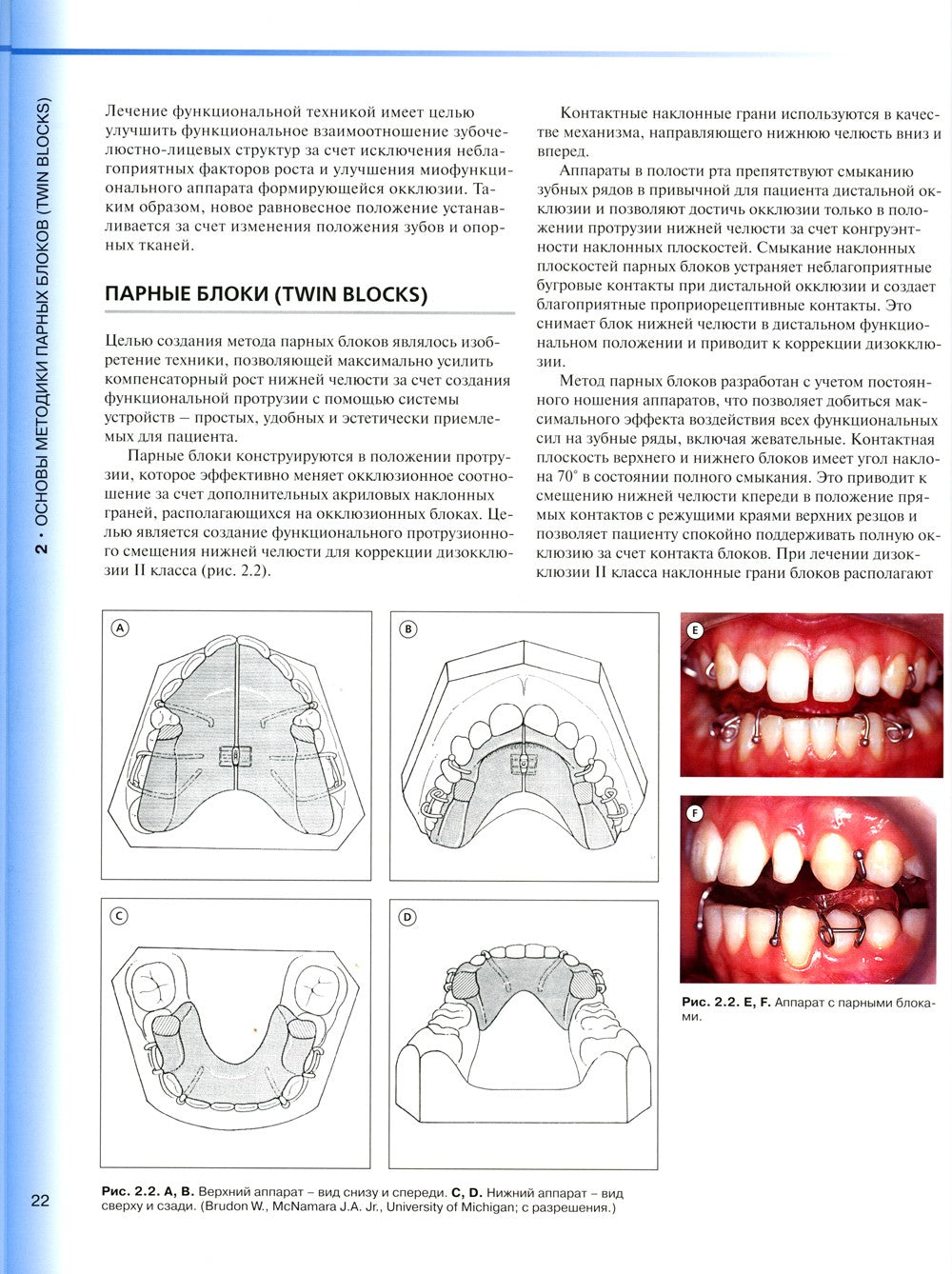Ортодонтическое лечение парными блоками. 3-е изд