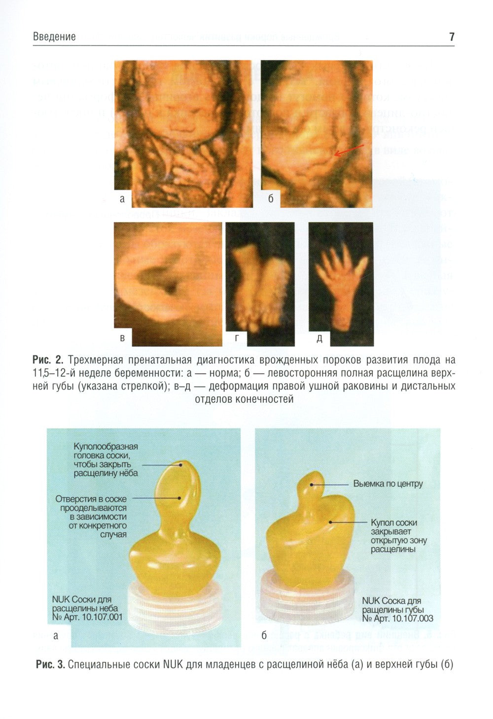 Врожденные пороки развития челюстно-лицевой области у детей: Учебное пособие