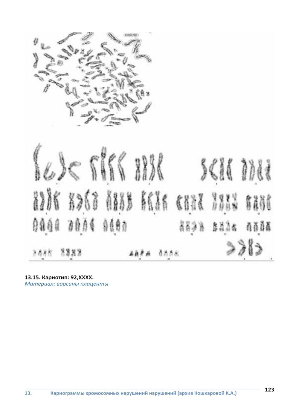 Врожденные пороки развития плода: атлас