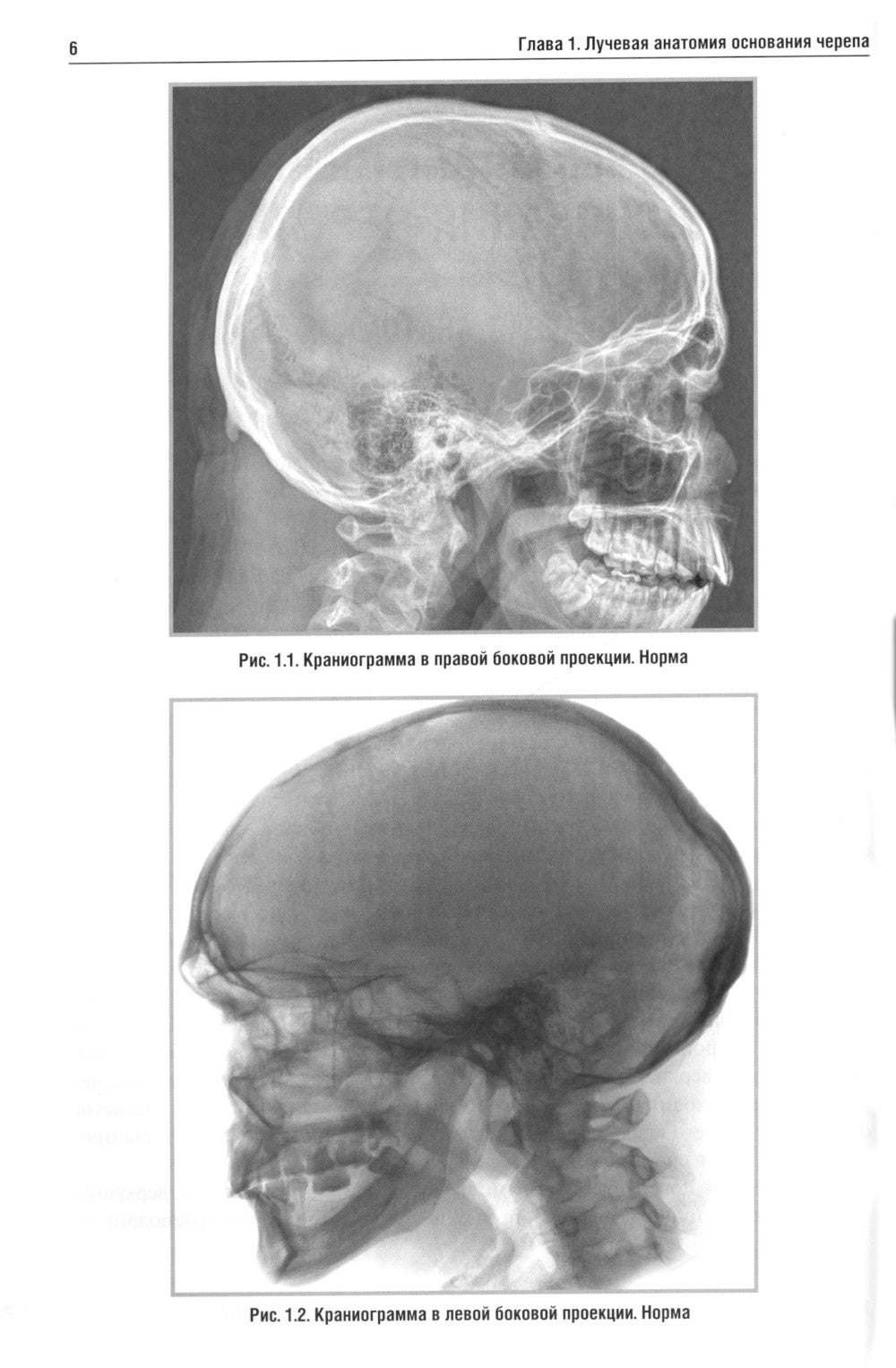 Лучевая диагностика заболеваний оснований черепа и мостмозжечкового угла: Уче...