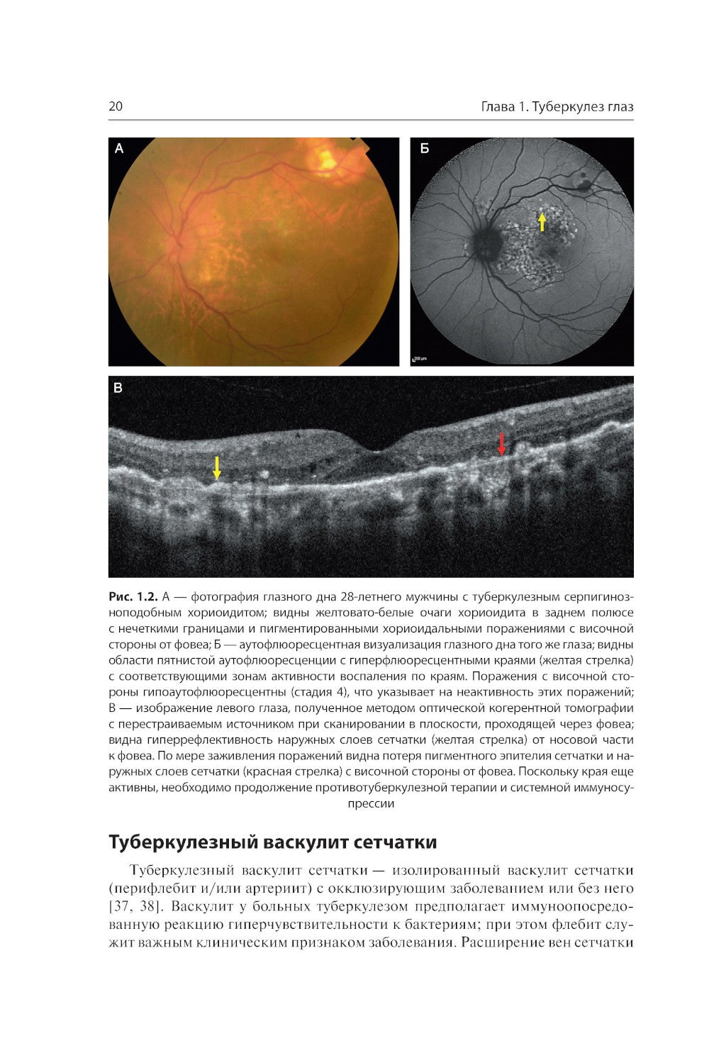 Инфекции глаз