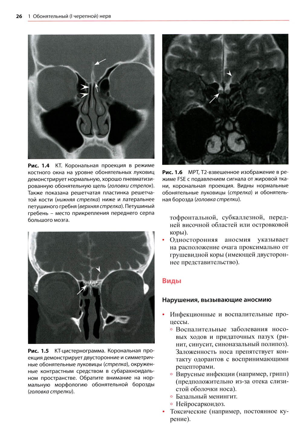 Черепные нервы: анатомия, патология, визуализация. 3-е изд