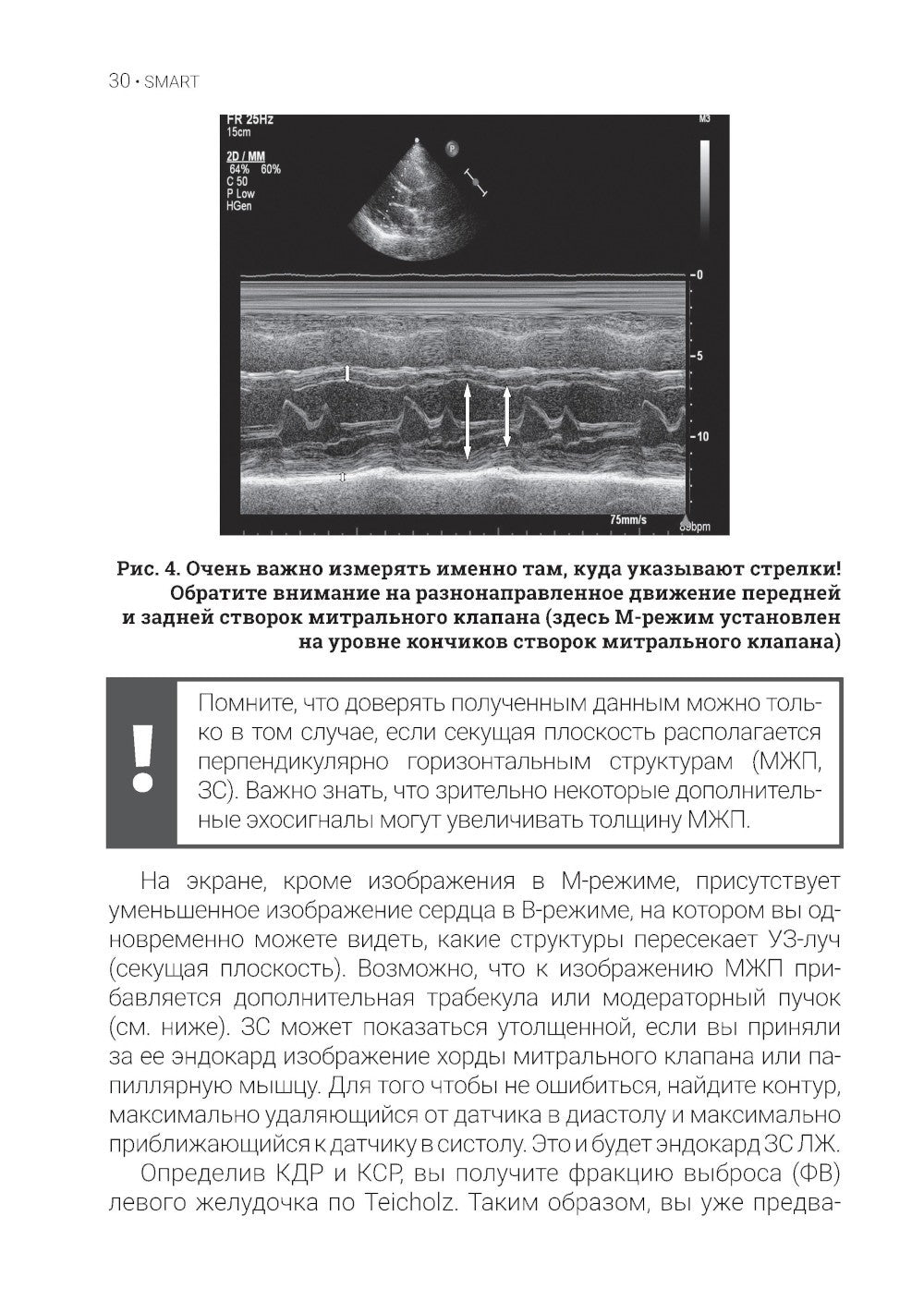 Эхокардиография для начинающих. 2-е изд., перераб. и доп