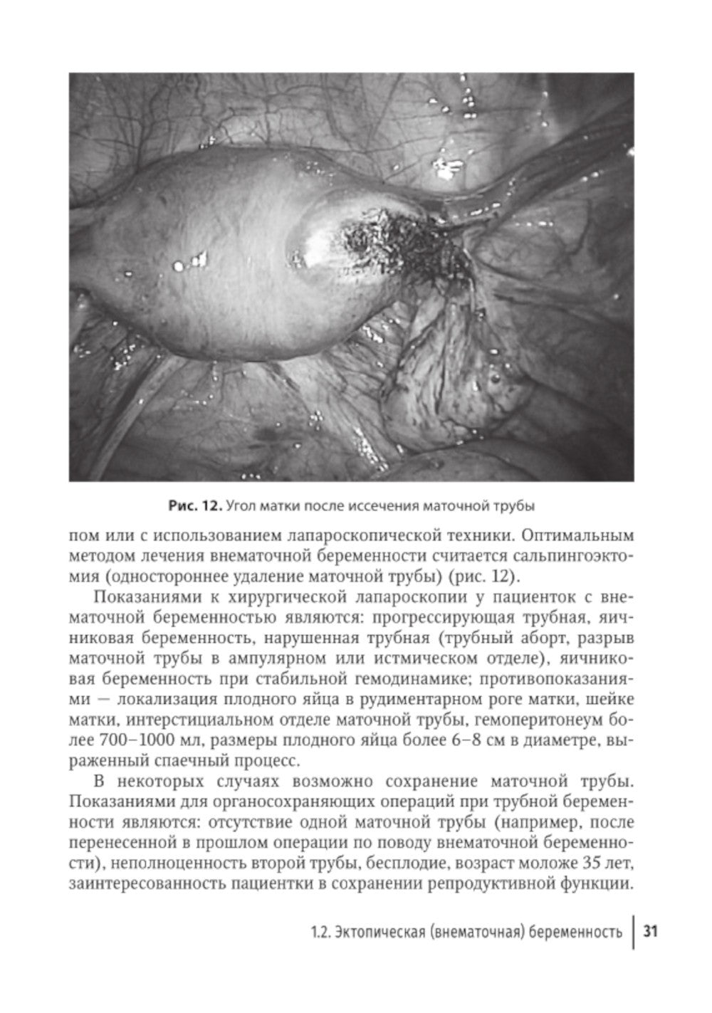 Острый живот в гинекологии: руководство для врачей