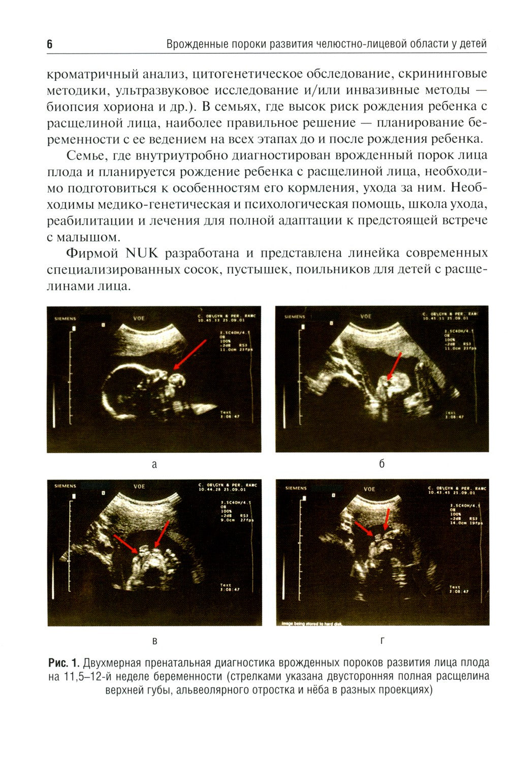 Врожденные пороки развития челюстно-лицевой области у детей: Учебное пособие