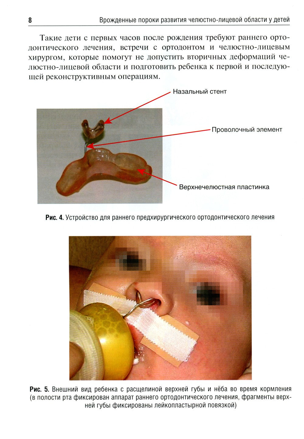 Врожденные пороки развития челюстно-лицевой области у детей: Учебное пособие