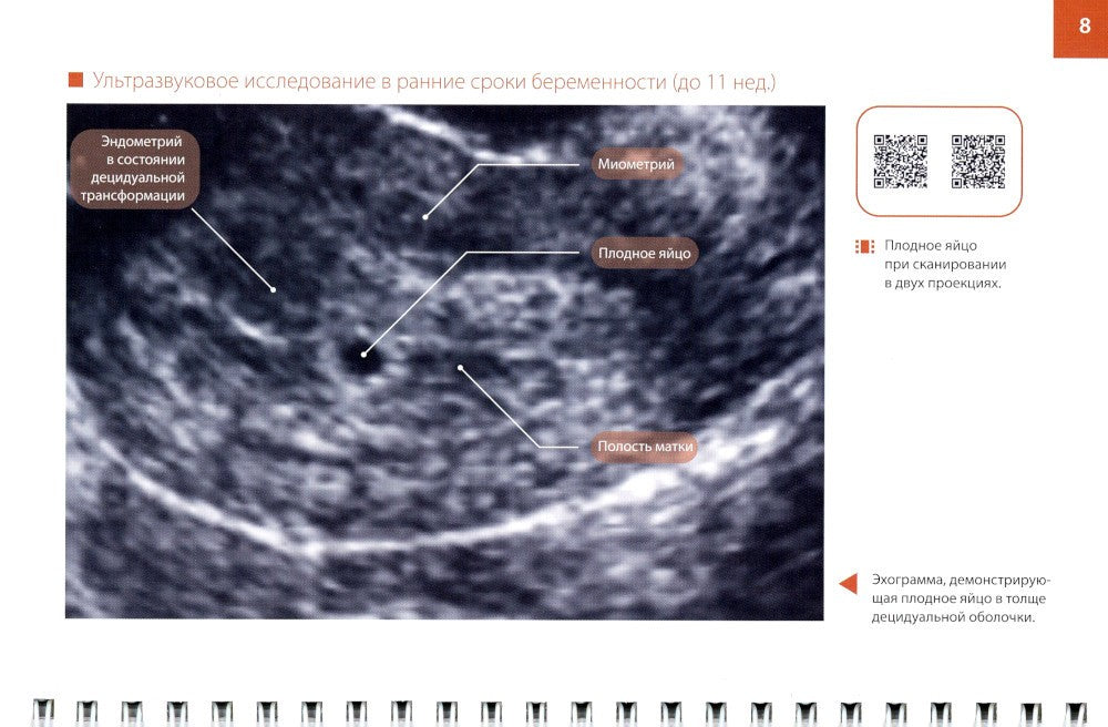 Атлас по ультразвуковой диагностике в акушерстве (эхограммы с комментариями):...
