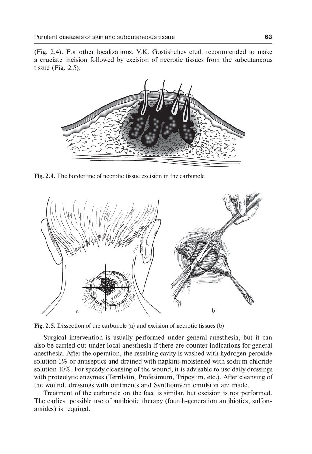 Surgical diseases: textbook. In 2 v. V. 1: на англ.яз