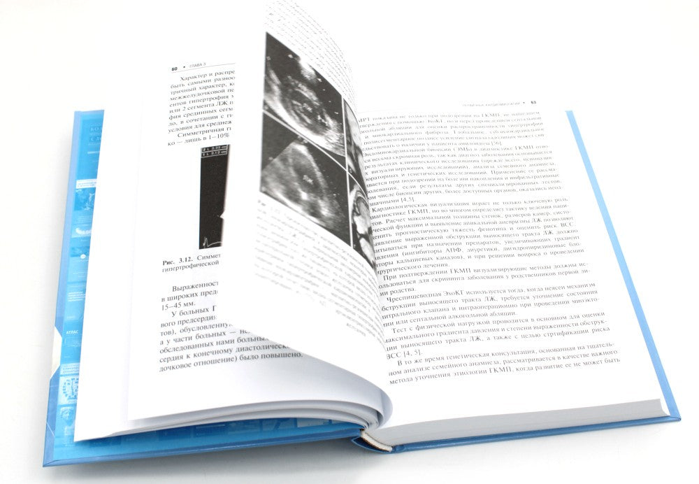 Кардиомиопатии и миокардиты. 2-е изд., перераб. и доп