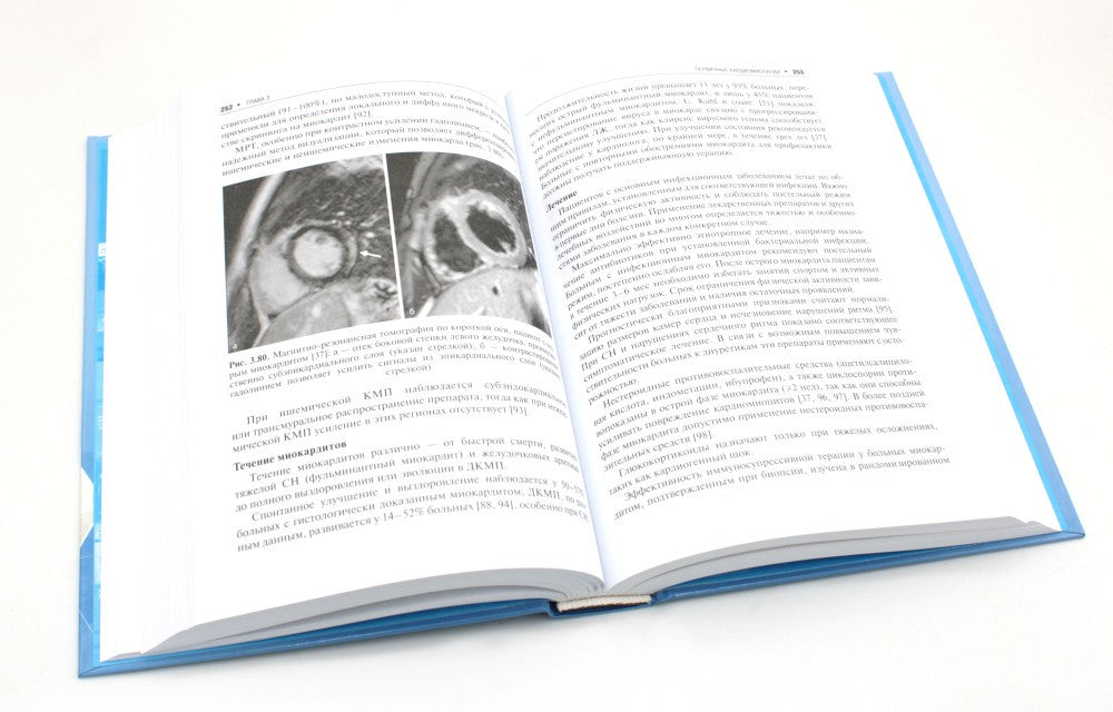 Кардиомиопатии и миокардиты. 2-е изд., перераб. и доп