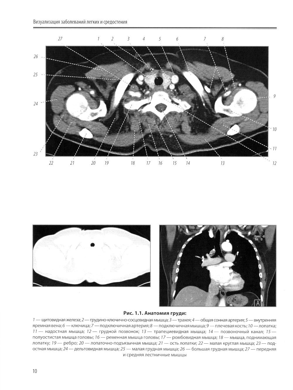 Визуализация заболеваний легких и средостения