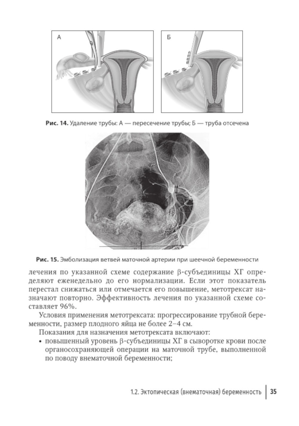 Острый живот в гинекологии: руководство для врачей