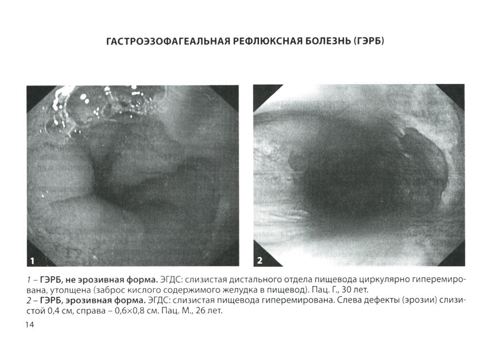 Гастроэнтерология. Практическое руководство 9-е изд., доп
