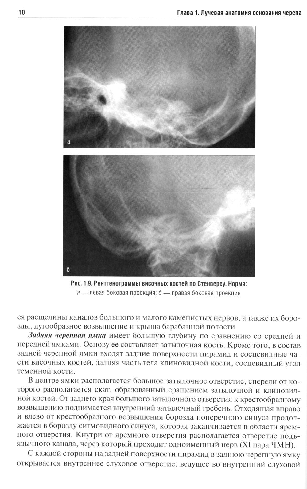 Лучевая диагностика заболеваний оснований черепа и мостмозжечкового угла: Уче...
