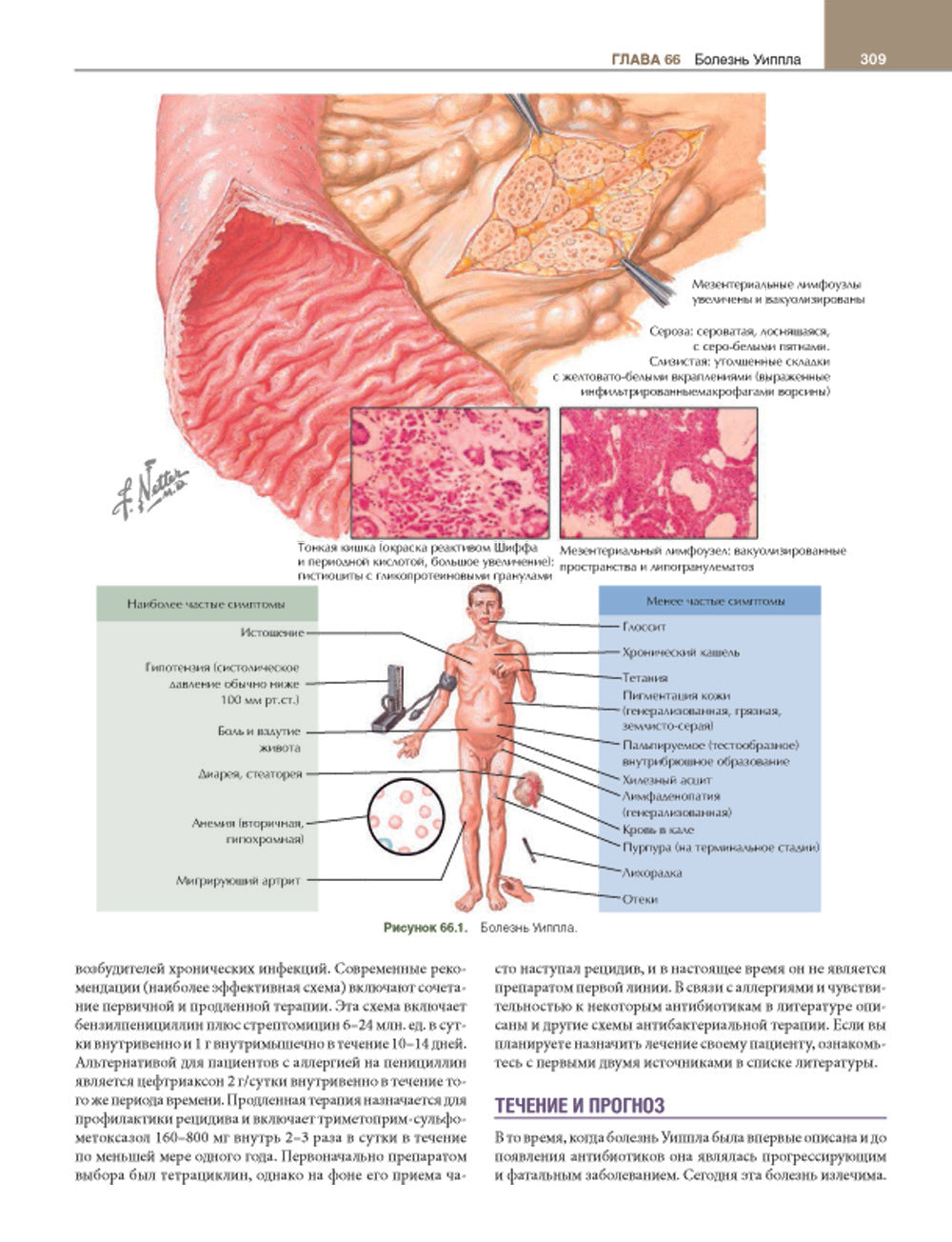 Гастроэнтерология с иллюстрациями Неттера. В 2 ч. (комплект из 2 кн.)
