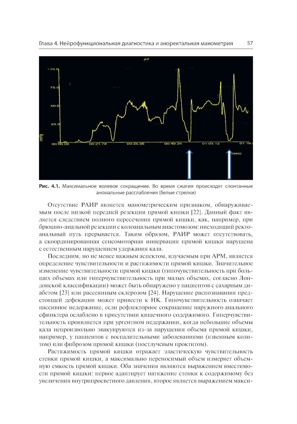 Анальная инконтиненция. Клиническое ведение и хирургическая тактика