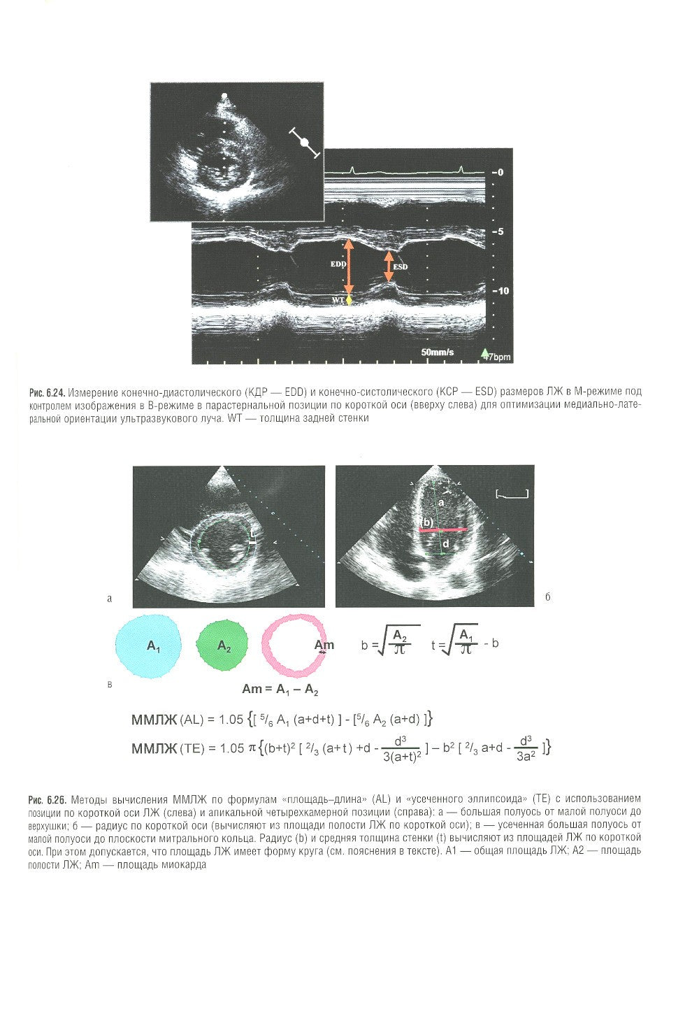 Кардиология: национальное руководство. 2-е изд., перераб. и доп