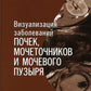 Визуализация заболеваний почек, мочеточников и мочевого пузыря: Учебное пособие