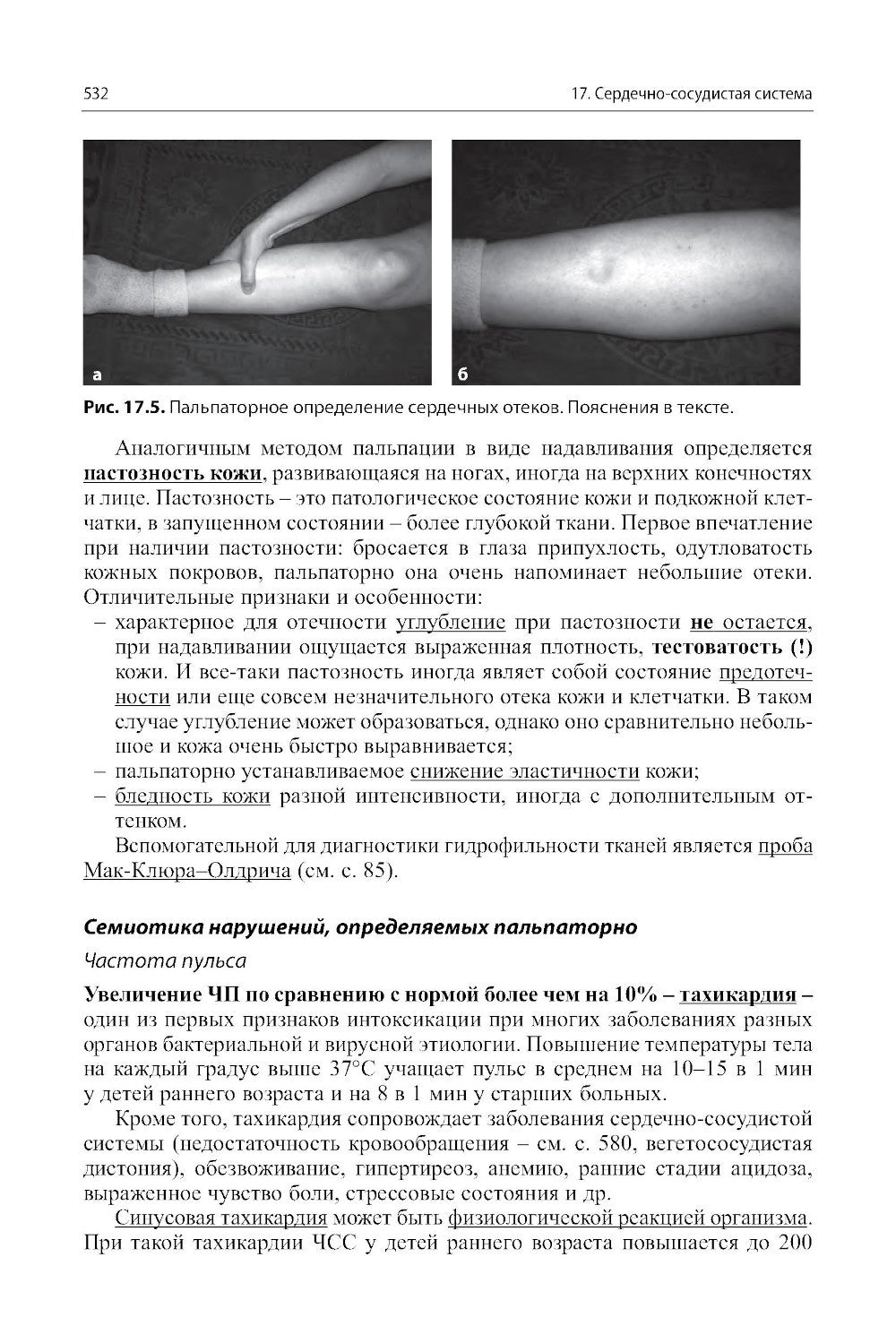 Пропедевтика детских болезней с уходом за детьми: Учебник для вузов. 7-е изд