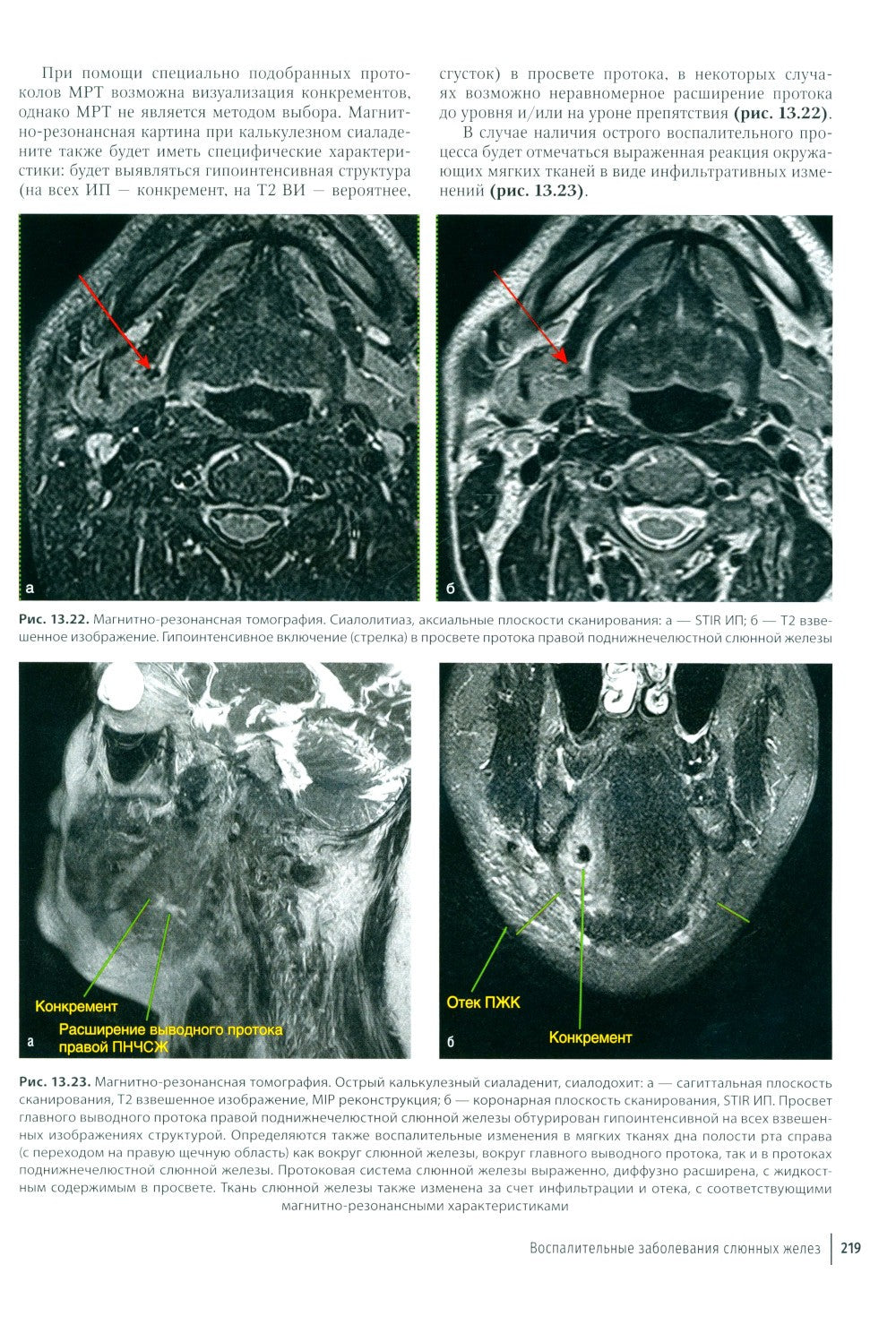Атлас диагностики заболеваний челюстно-лицевой области