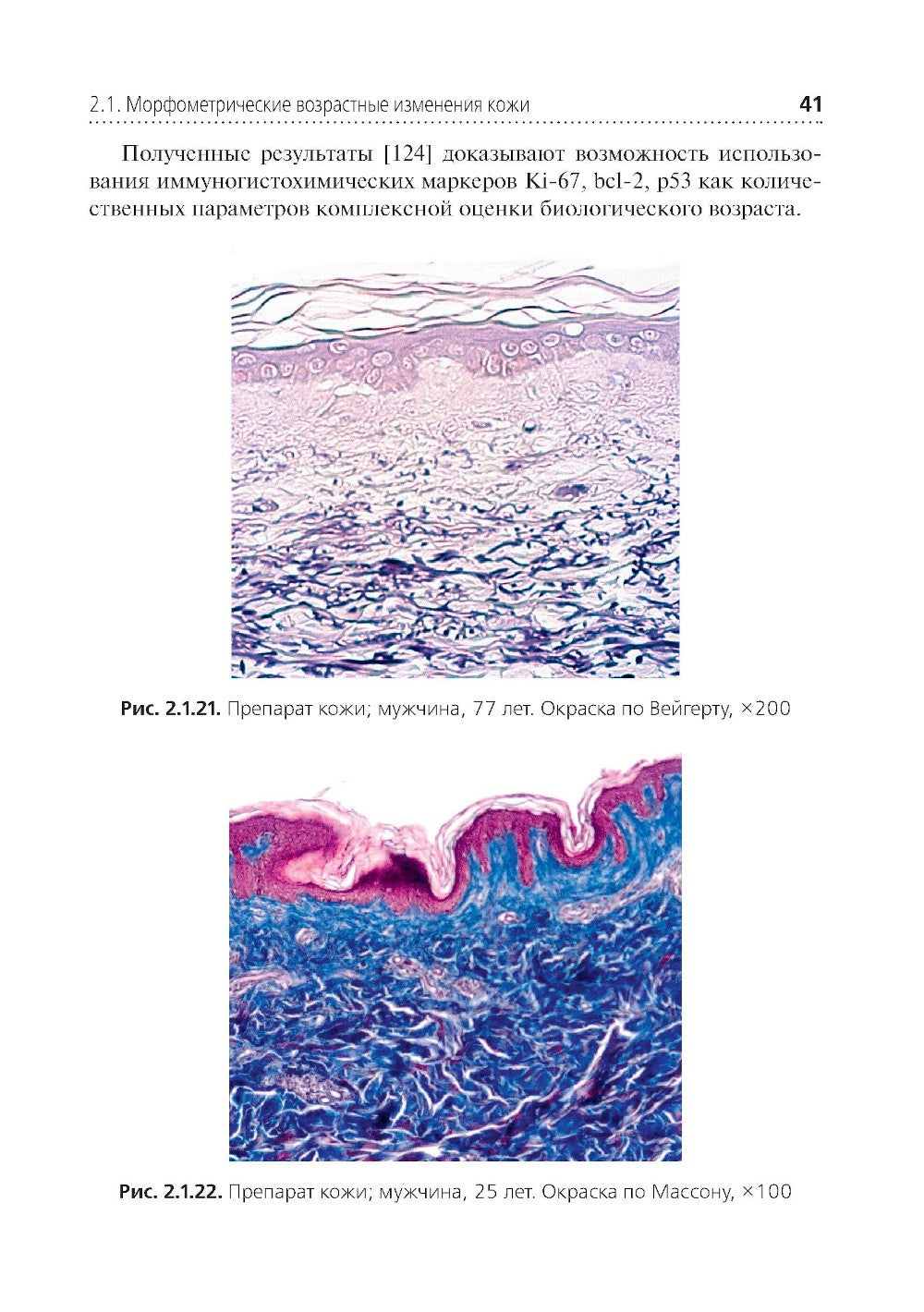 Комплексная оценка возрастных изменений при судебно-медицинской идентификации...