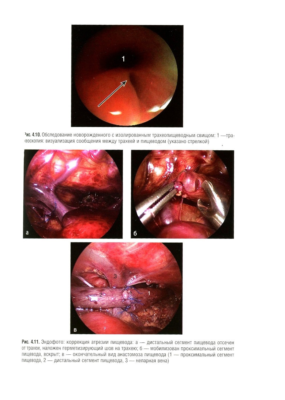 Детская гастроэнтерология. Национальное руководство