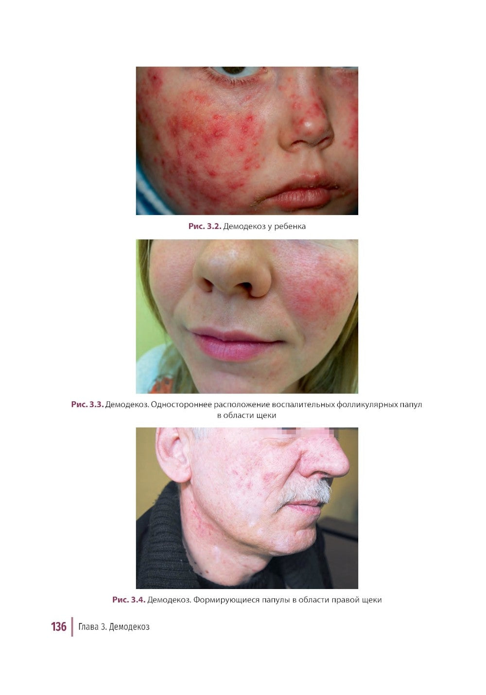 Дерматозы лица: иллюстрированное руководство для врачей